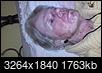 Frequent tanner shares grisly skin-cancer selfie-2012-01-23_17-13-13_993.jpg