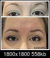 Help me understand micro-bladed eyebrows-df599f34-9426-4385-bdda-61c42fe234cb.jpeg