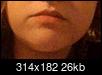Side of face and arm on same side bigger/fatter than other side-win_20150311_222742-2-.jpg