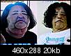 Cosmetic-surgery-addict- injected cooking oil-kor3_1111850c.jpg