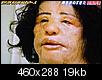 Cosmetic-surgery-addict- injected cooking oil-kor2_1111849c.jpg