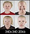 Why is there racism?-5722_albinos-black-people.jpg