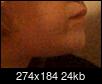 Side of face and arm on same side bigger/fatter than other side-win_20150311_222415-2-.jpg