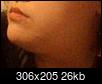Side of face and arm on same side bigger/fatter than other side-win_20150311_222421-2-.jpg