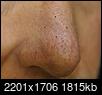 Cut on nose....will there be a scar...pics enclosed-nose-2-.jpg