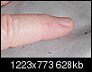 What is this bump on my finger?-hpim1740.jpg