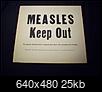 Ongoing Measles Outbreak in California: 51 so far linked to Disneyland-measles.jpg