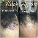 Hair Again Certified Hair Loss Specialists