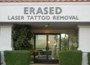 Erased Laser Tattoo Removal