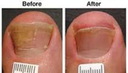 Clear Toes Clinic