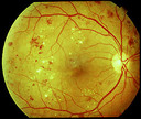 EyeSite of The Villages - optometrist eye exams eyeglasses optical lab fl